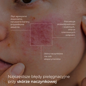 Veoli Botanica Redness Rescue Peel kojąco-wygładzający peeling na naczynka 30 ml