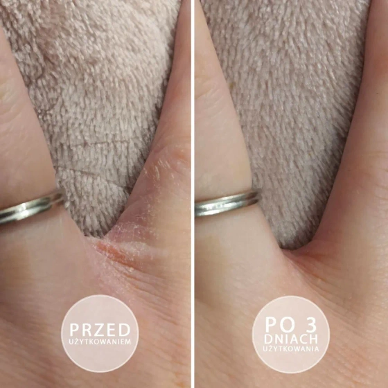 Beautica S.O.S. intensywnie natłuszczająca maść do dłoni i stóp z witaminą E 15 ml